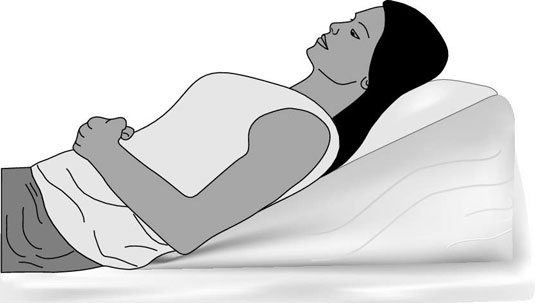 La mejor posición para dormir para disminuir el reflujo ácido
